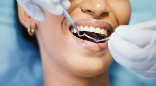 Best Emergency Dentist for Lost Fillings or Crowns in Wixom, MI