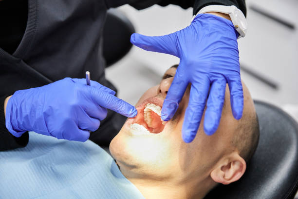 Best Emergency Dentist for Lost Fillings or Crowns in Wixom, MI